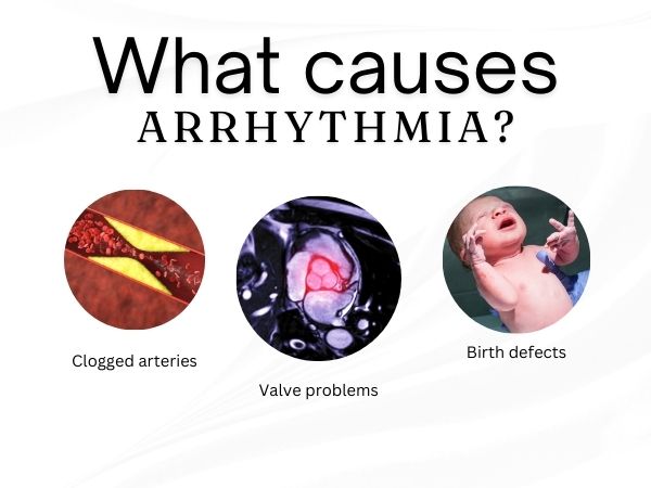 What causes arrhythmia
