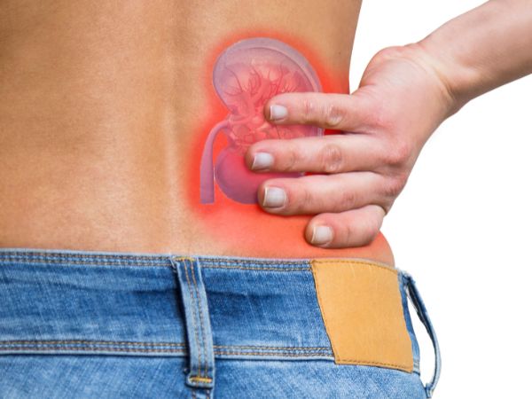Kidney Stones_ When to Seek Medical Attention & Urgent Care