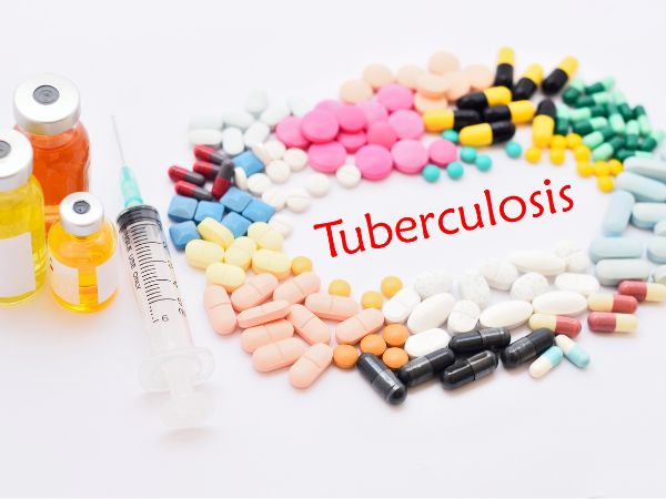 Decoding the Enigma: Unveiling Mycobacterium Tuberculosis