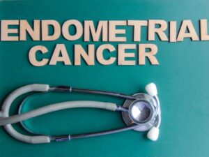 A Comprehensive Guide to Endometrial Cancer
