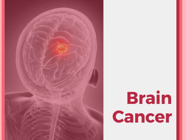 Brain Cancer_ Types, Symptoms, and Empowered Health Strategies