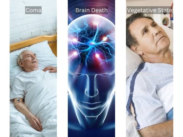 Coma Vs Brain Death Vs Vegetative State