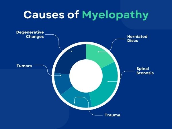 Causes of Myelopathy