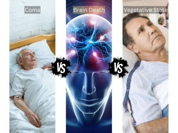 Coma vs. brain Death vs. vegetative State