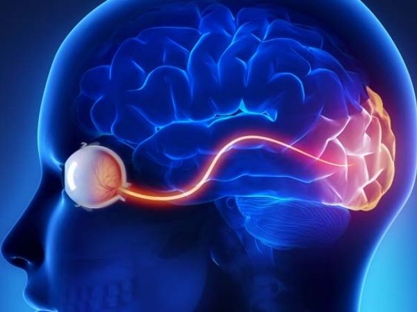 What is Neuritis? Types, Causes and Symptoms