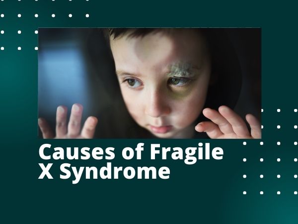 What are the Causes of Fragile X Syndrome
