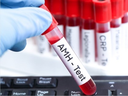AMH Testing and How to Increase AMH Levels
