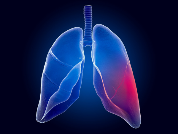 Effects of Asthma on the Lungs