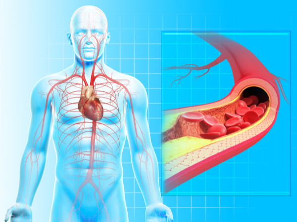 List of 15 common symptoms of cardiovascular disease to look out for!