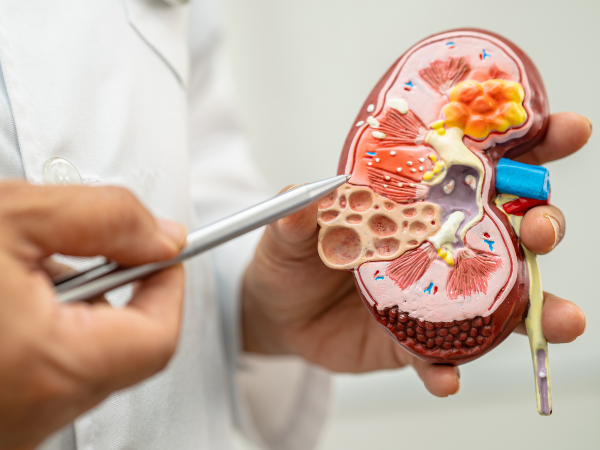 Overview of chronic kidney disease (CKD) 