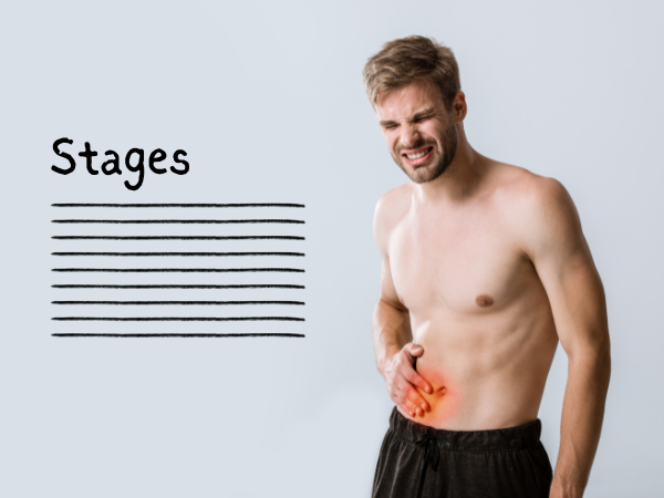 Stages of Chronic Kidney Disease