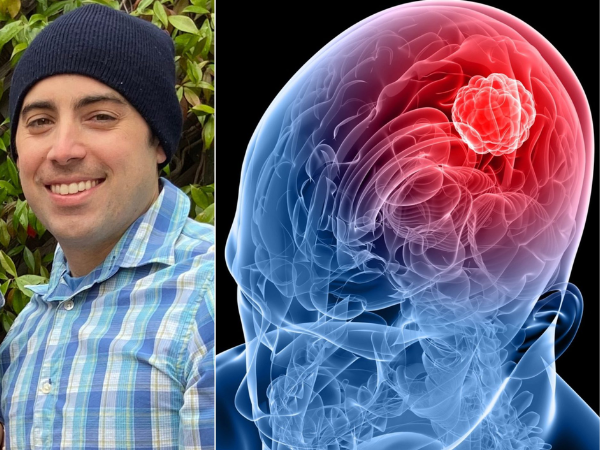 Living with Brain Tumor Cancer