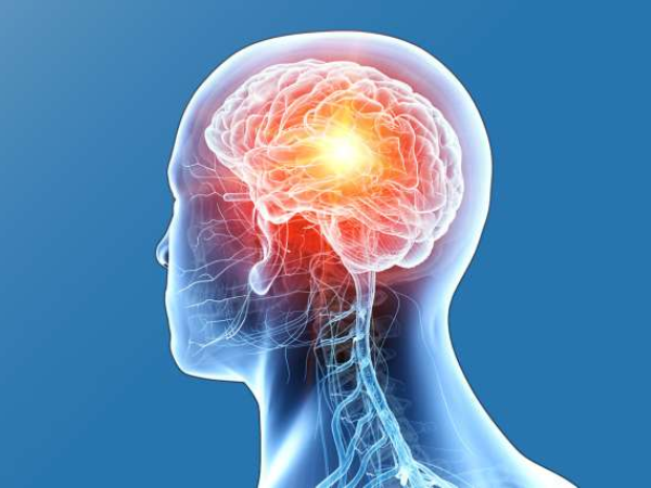 Symptoms of Brain Tumor Cancer