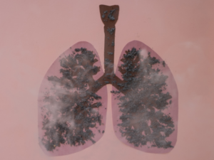 What All You Need To Know About What Disease Affects Lungs