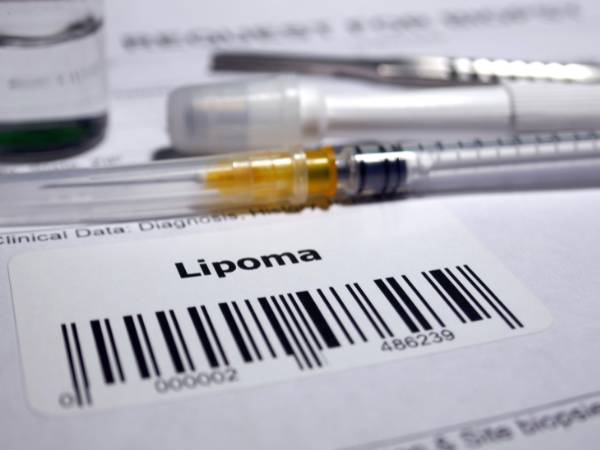 What Is a Lipoma